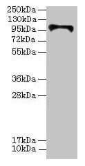 Polyclonal Rabbit anti-Human HKDC1 Antibody (IHC, WB)