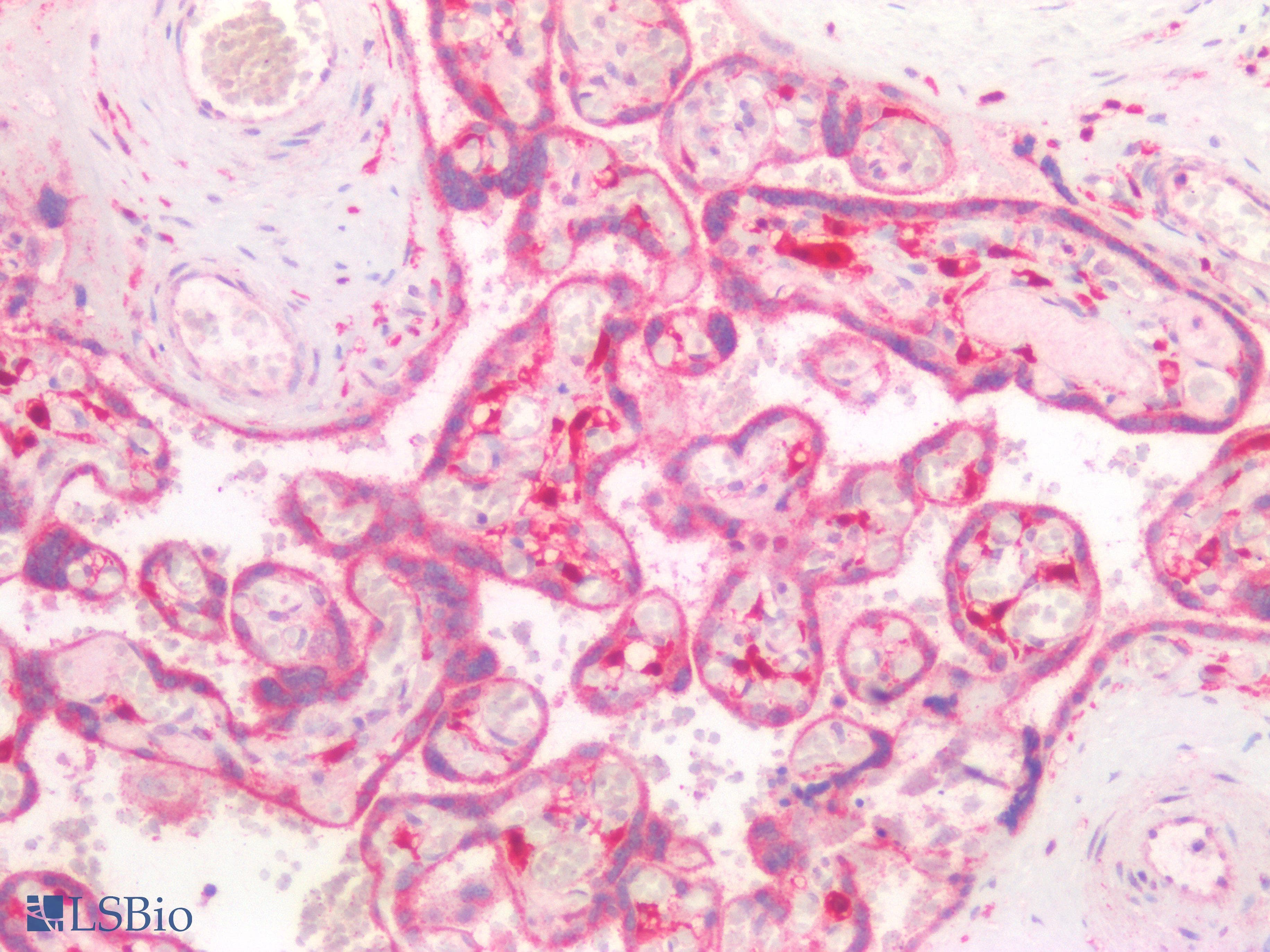 PathPlus™ Polyclonal Rabbit anti-Human GNAQ Antibody (IHC)