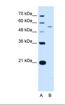 Polyclonal Rabbit anti-Human KCNQ2 Antibody (aa171-220, IHC, WB)