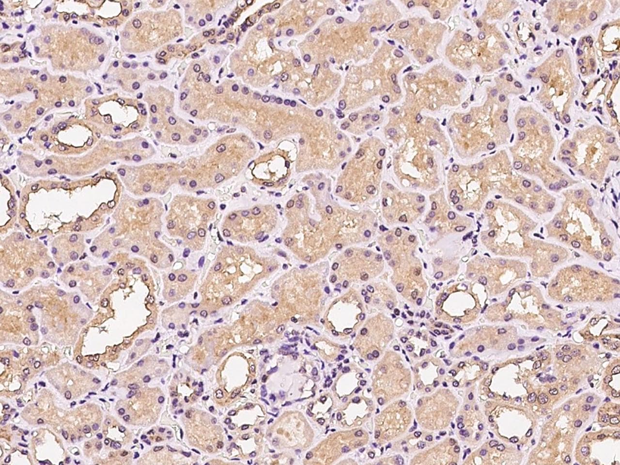 PIK3CB / PI3K Beta Antibody