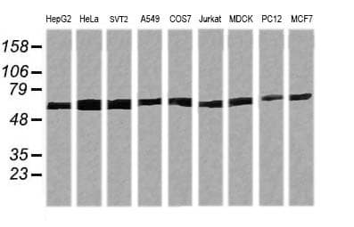 TRIM38 Antibody (aa1-265, clone OTI15A3, Carrier-free)