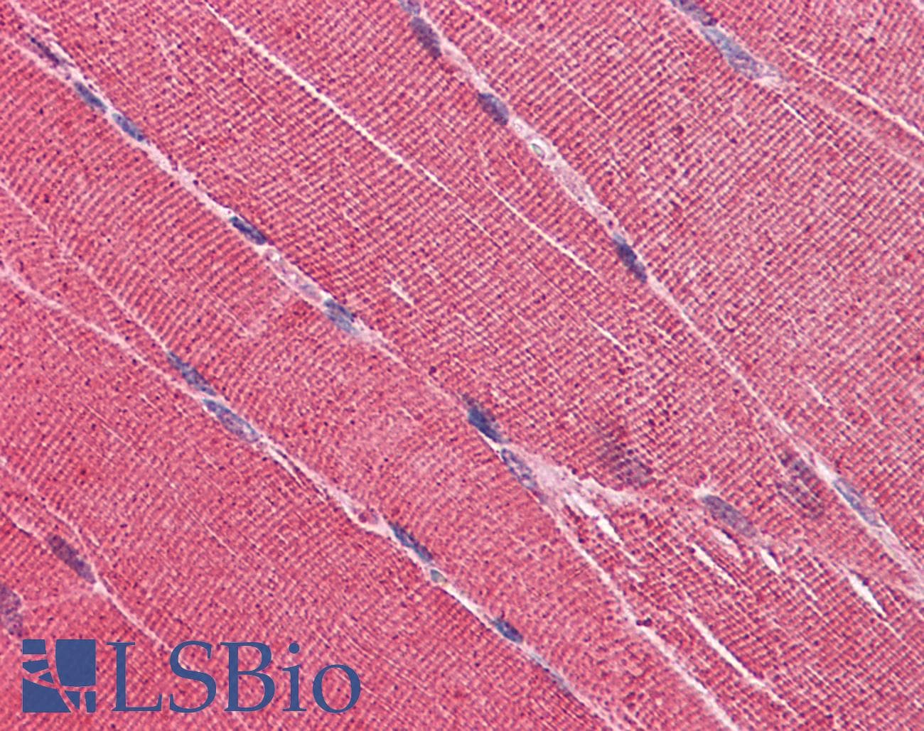 IHC-plus™ EDEM2 Antibody (clone 2E4)