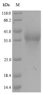 Human RANBP2 / TRP1 Protein (Recombinant 6His, N-terminus)