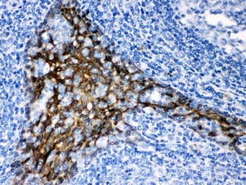 Polyclonal Rabbit anti-Human TRAF2 Antibody (IHC, WB)
