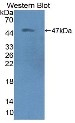 PACAP Antibody (aa17-176)