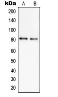 SLC6A17 Antibody (Internal)