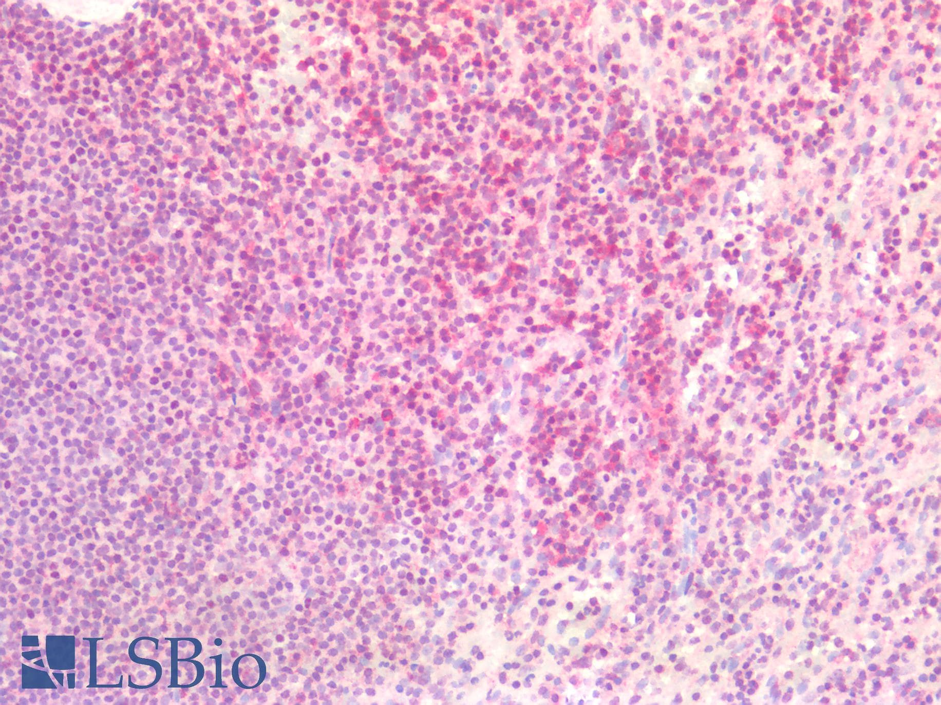 IHC-plus™ Polyclonal Rabbit anti-Human XRCC6 / Ku70 Antibody (acetylation site of K539., IHC, WB)