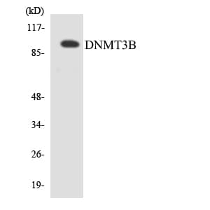 IHC-plus™ Polyclonal Rabbit anti-Human DNMT3B Antibody (aa7-56, IHC, WB)