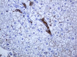 KRT5 / CK5 / Cytokeratin 5 Antibody (aa1-273, clone OTI1E7)