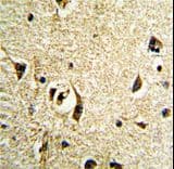 FTO Antibody (aa1-30)