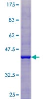 Human IDNK Protein (Recombinant GST)