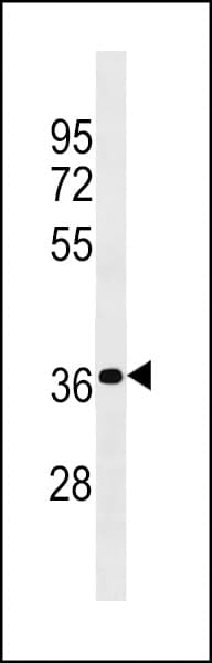 Polyclonal Rabbit anti-Human PSG4 Antibody (aa73-100, WB)