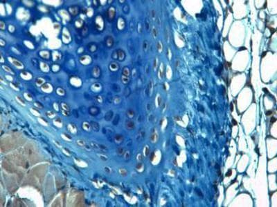 ACAN / Aggrecan Antibody (DY488)