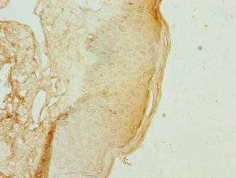 KRTAP3-2 Antibody