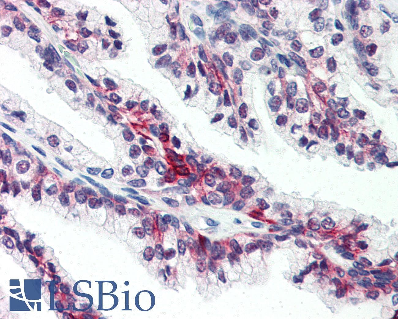 IHC-plus™ Polyclonal Rabbit anti-Human SLC39A6 / LIV-1 Antibody (Internal)