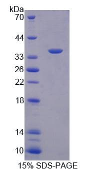 Human SDCBP / Syntenin Protein (Recombinant His-T7)