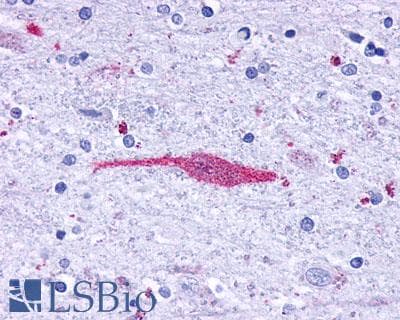 PathPlus™ Leukotriene B4 Receptor / BLT1 Antibody (C-Terminus)