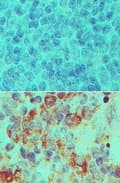 Polyclonal Rabbit anti-Human IPO7 / RANBP7 Antibody (aa1-50, IHC, WB)