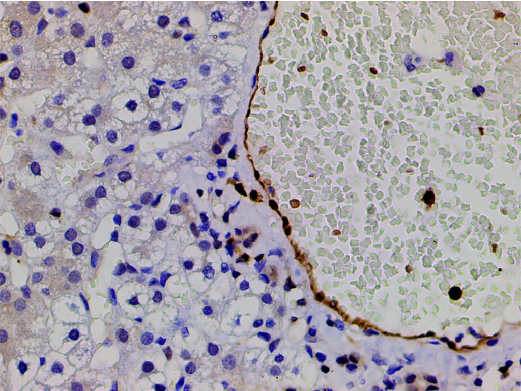 CFL1 / Cofilin Antibody (phospho-Ser3)