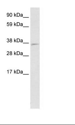 MXI1 / MAD2 Antibody (aa176-225)