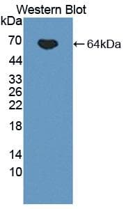 IL12B / IL12 p40 Antibody (aa23-324)