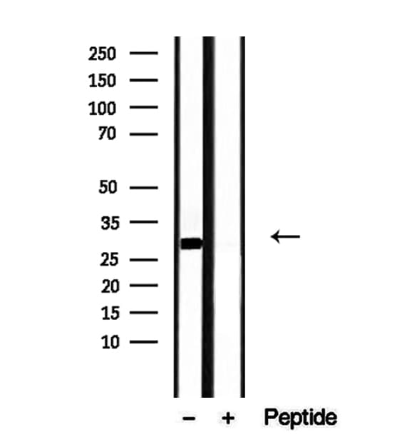 Polyclonal Rabbit anti-Human DNAJB3 Antibody (IHC, WB)