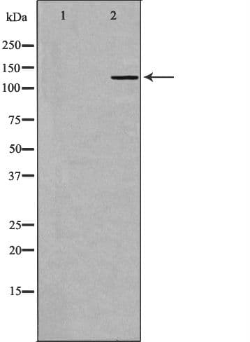 Polyclonal Rabbit anti-Human GRM1 / MGLUR1 Antibody (IHC, IF, WB)