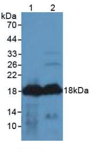 AGRP Antibody (aa20-130, APC)