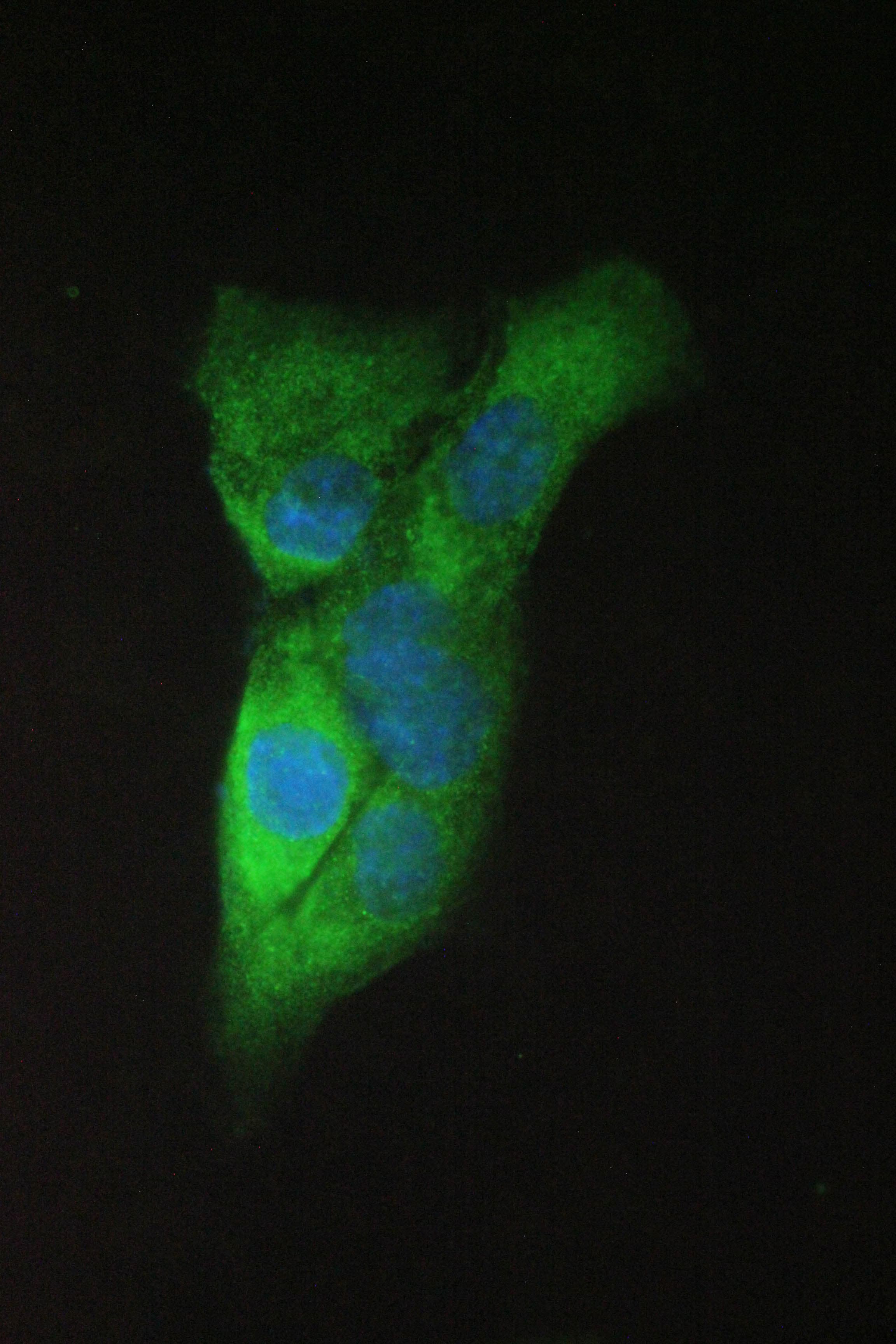 APP / Beta Amyloid Precursor Antibody (aa672-713)