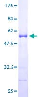 Human ARHGDIA / RHOGDI Protein (Recombinant GST)