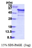 Human YBX1 / YB1 Protein (Recombinant His)