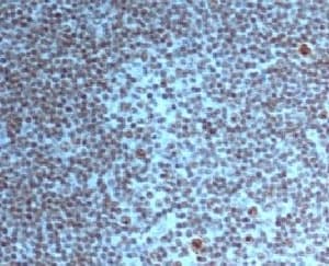 Nuclear Membrane Marker NM97 Antibody (clone NM95)