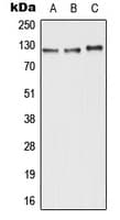 ABCC11 / MRP8 Antibody (N-Terminus)