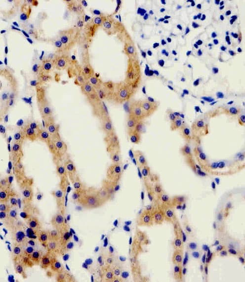 Polyclonal Rabbit anti-Human ADRA1D / Adrenoceptor alpha 1D Antibody (aa1-30, IHC, WB)