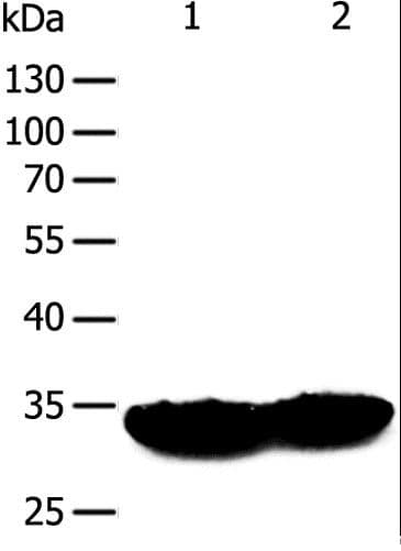 TPM1 / Tropomyosin Antibody