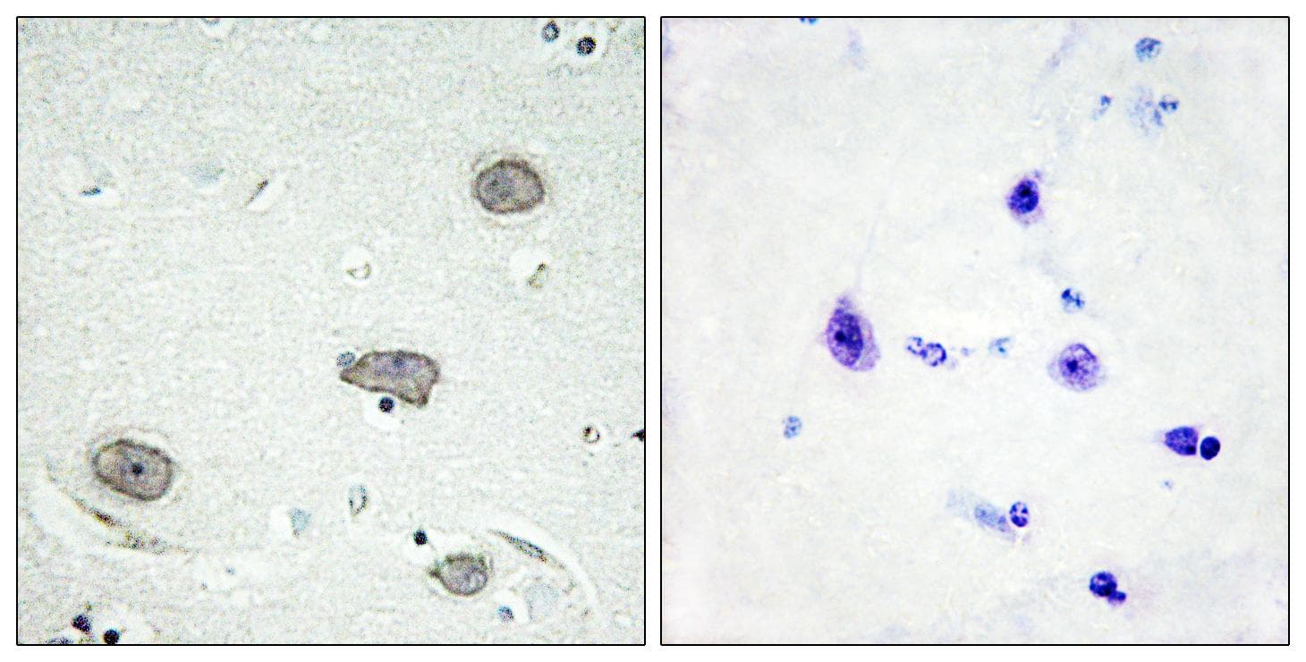 Polyclonal Rabbit anti-Human CSF1R / CD115 / FMS Antibody (phospho-Tyr809, IHC)