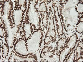 ZSCAN18 / ZNF447 Antibody (clone OTI2H7, Carrier-free)