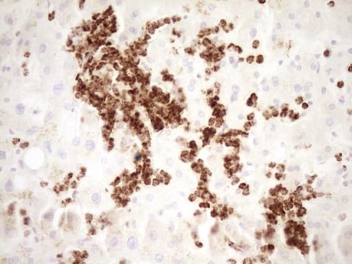 TFPI / LACI Antibody (aa29-304, clone OTI5H5)
