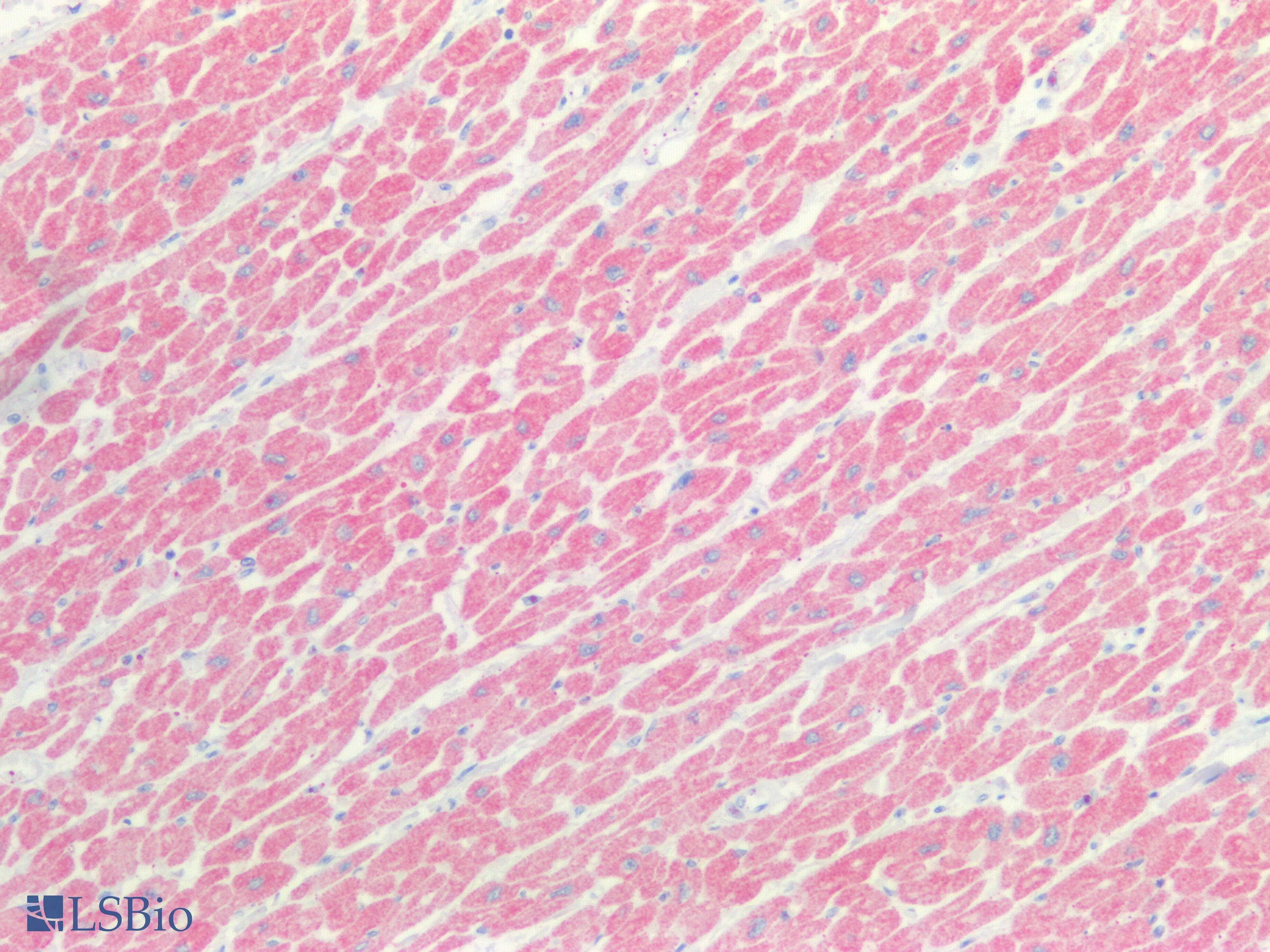 PathPlus™ MYH1 Antibody (aa585-794)