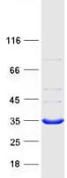 Human DNAJC27 Protein (Recombinant Myc-DDK (Flag))