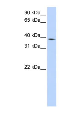 P40PHOX / NCF4 Antibody (aa216-265)