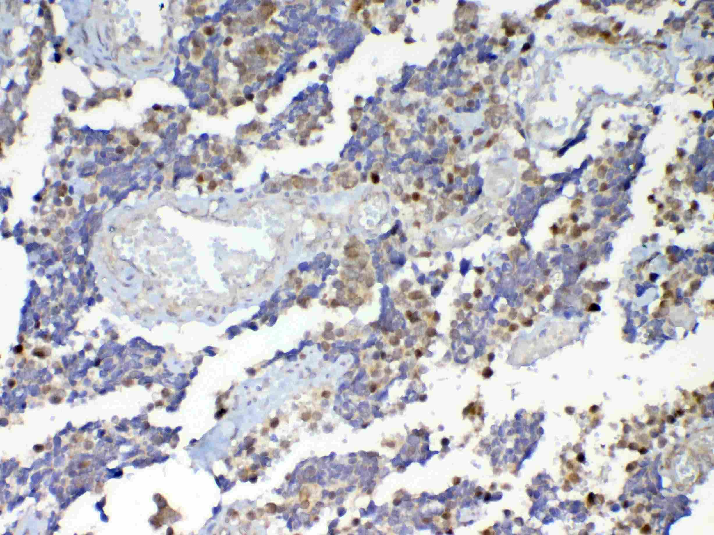 DNMT / DNMT1 Antibody