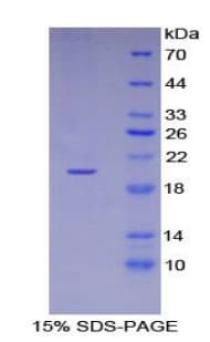 Mouse p16INK4a / CDKN2A Protein (Recombinant His, N-Terminal)