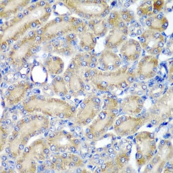 IHC-plus™ PDCD6 / ALG-2 Antibody