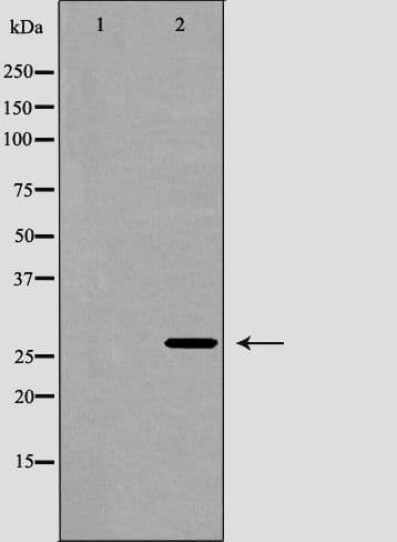 Polyclonal Rabbit anti-Human Survival Motor Neuron Domain Containing 1 (SMNDC1) Antibody (IHC, IF, WB)