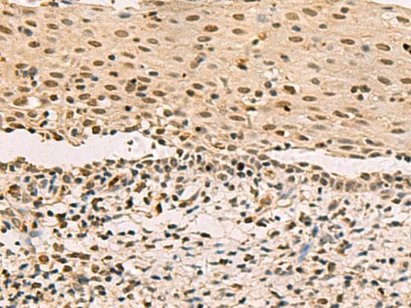 LRIF1 / RIF1 Antibody