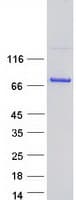 Human EXOC7 Protein (Recombinant Myc-DDK (Flag))