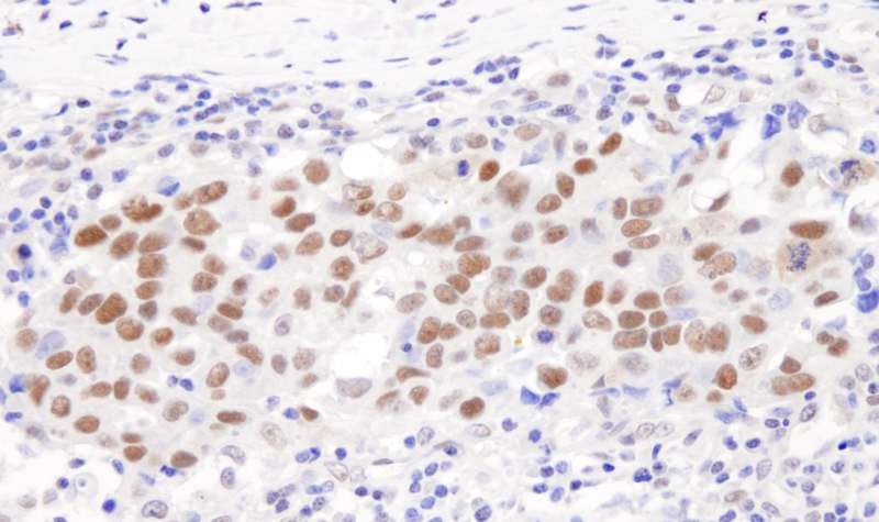 GTF2I / TFII I Antibody (aa950-C-term)