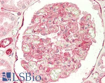 IHC-plus™ Polyclonal Rabbit anti-Human TMPRSS2 / Epitheliasin Antibody (aa100-470, IHC, WB)
