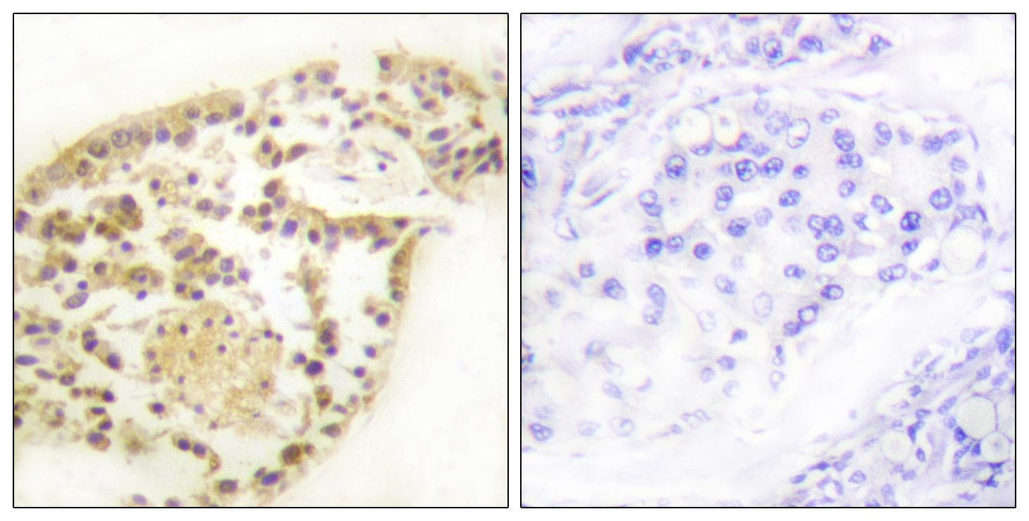 Polyclonal Rabbit anti-Human Vimentin Antibody (phospho-Ser83, IHC, WB)